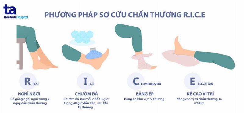 Cách xử lý căng cơ chân tại nhà theo nguyên tắc RICE